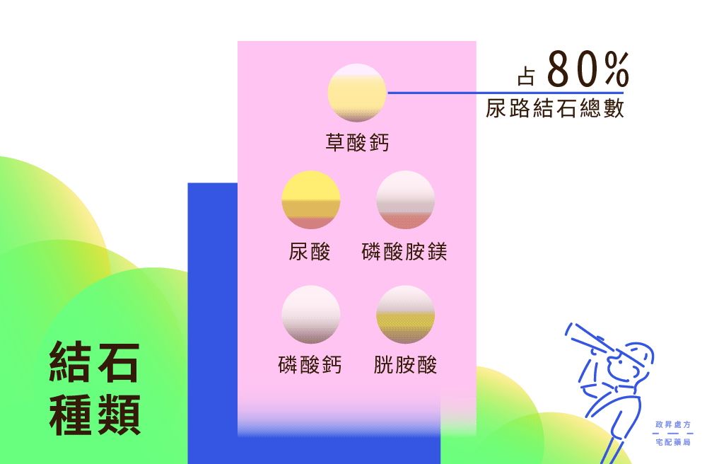 體內結石因組成成分而有不同