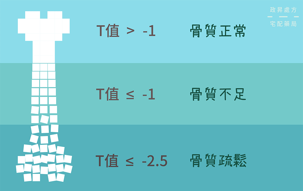 骨質疏鬆症T值檢測的三種不同結果