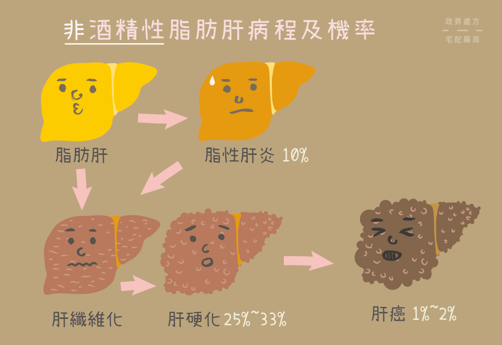 非酒精脂肪肝的病程發展與患病機率