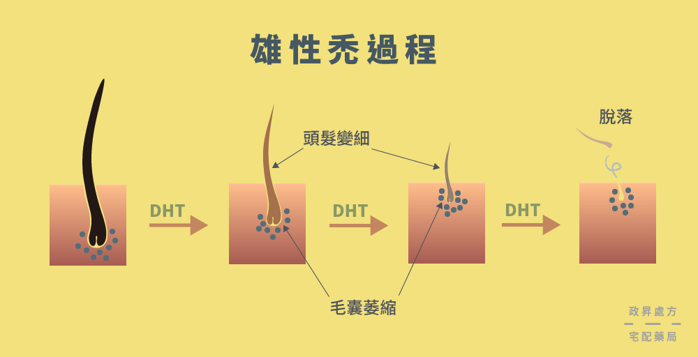 DHT 的致病過程