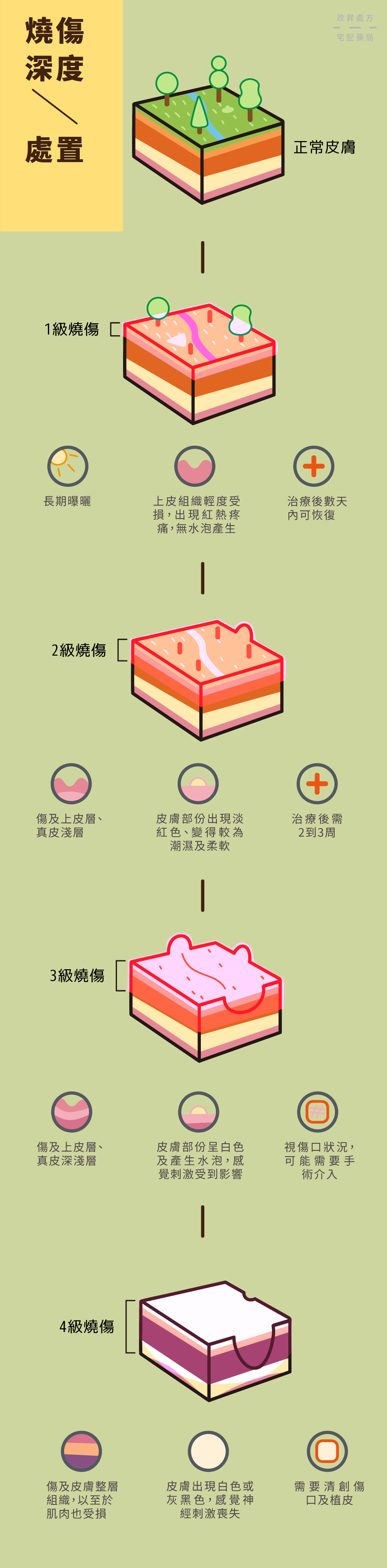 五個塊狀分層皮膚，循序介紹1-4級燒傷