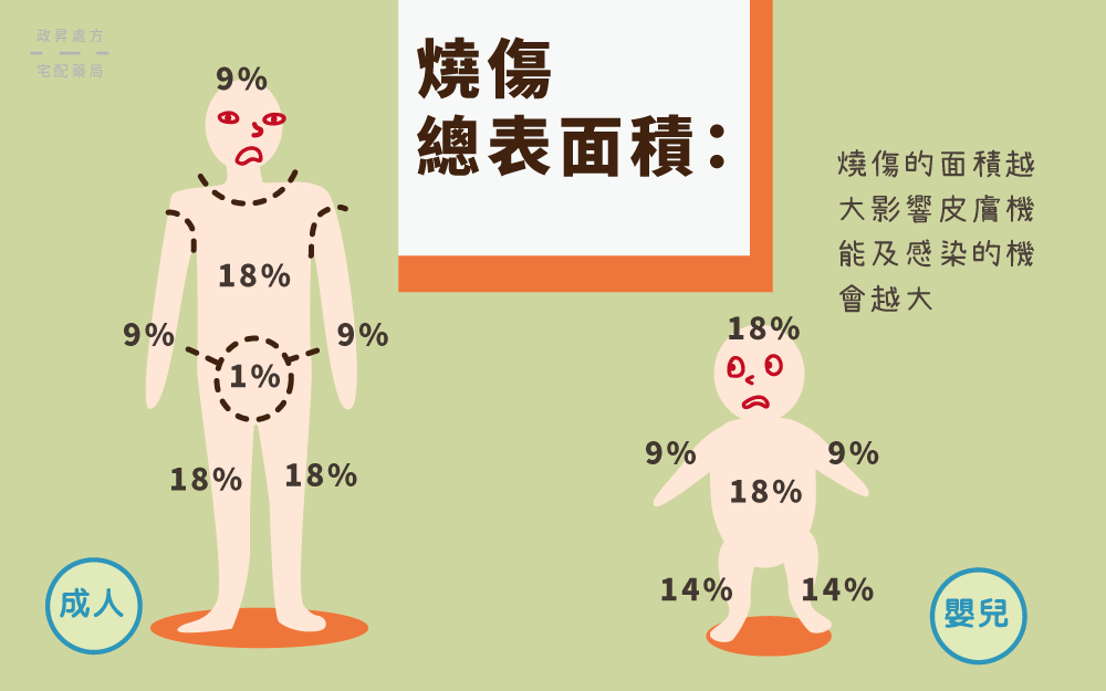 成人與嬰兒的全身表面積百分比