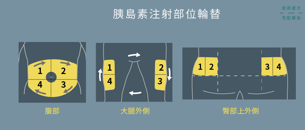 腹部、大腿、臀部的注射部位輪替示意