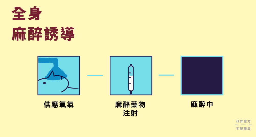 人臉、針筒與黑方塊表示全身麻醉誘導步驟