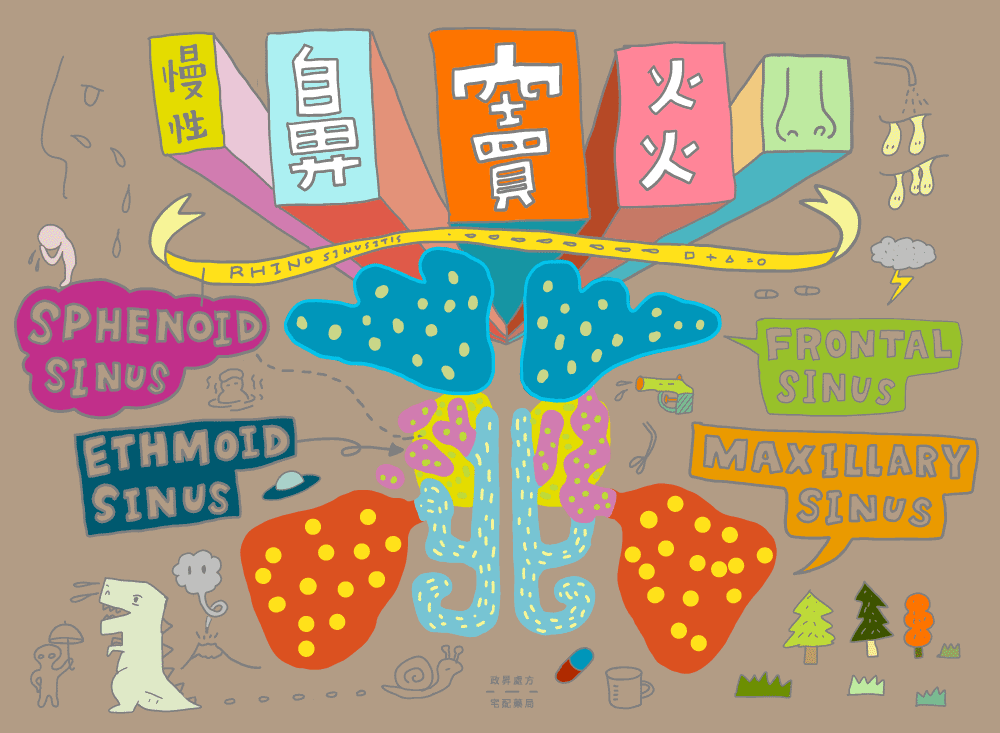 慢性鼻竇炎示意圖