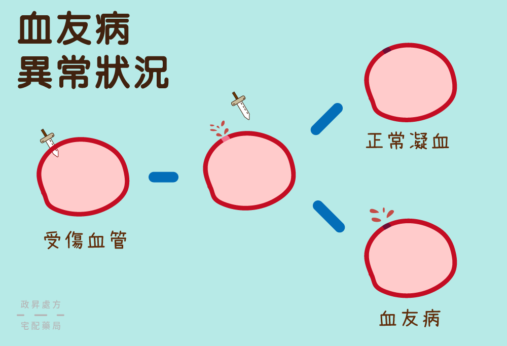 四個粉紅圓圈表示血管的正常與異常凝血現象