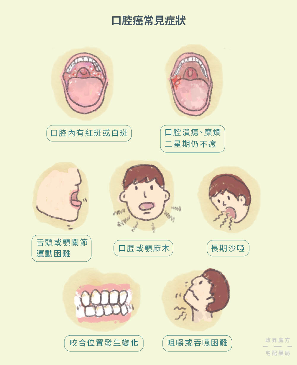 七種口腔癌常見症狀