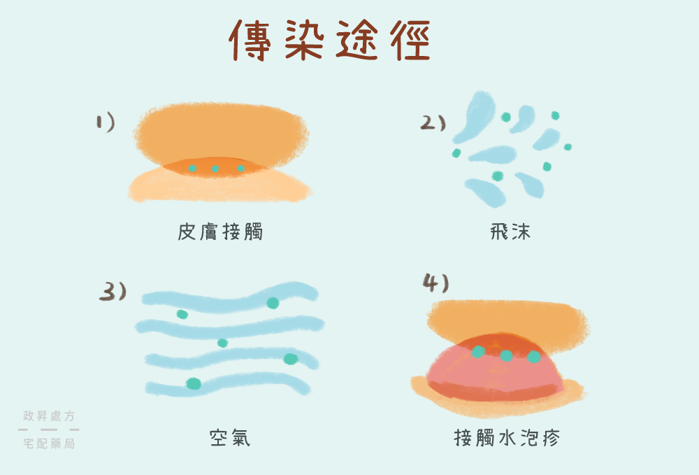 四種水痘的傳染途徑