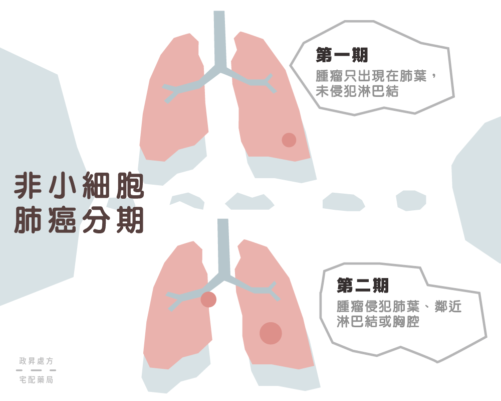 第一期與第二期肺癌的變化