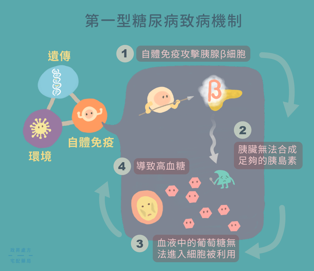 第一型糖尿病致病機制的 4 個階段