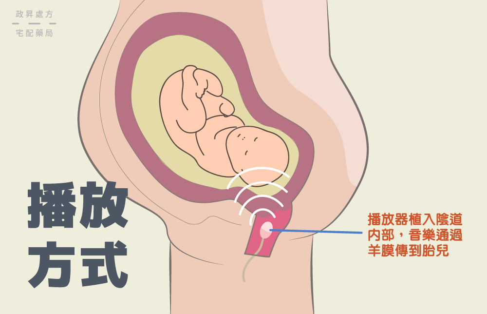 陰道播放器擺放位置