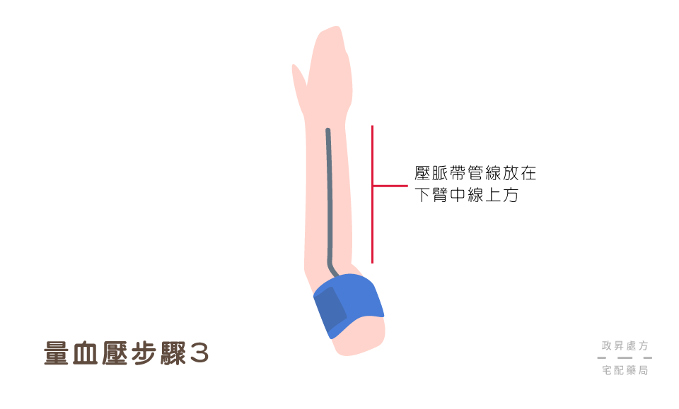 壓脈帶管線放在下臂中線上方