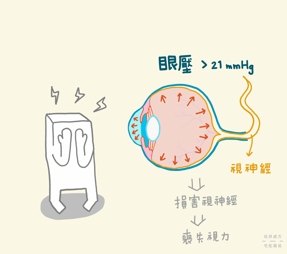 青光眼與眼壓的影響