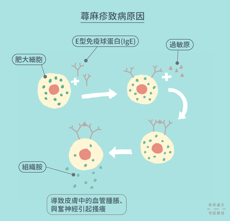 蕁麻疹致病原因